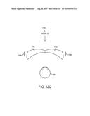 DISPLAYING AUGMENTED REALITY OR VIRTUAL REALITY THROUGH A SUBSTRATE     COUPLED TO THE USER S EYE diagram and image