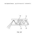 DISPLAYING AUGMENTED REALITY OR VIRTUAL REALITY THROUGH A SUBSTRATE     COUPLED TO THE USER S EYE diagram and image