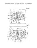 LEG ALIGNMENT APPARATUS AND METHOD diagram and image