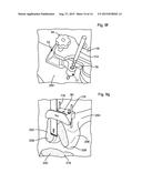 LEG ALIGNMENT APPARATUS AND METHOD diagram and image