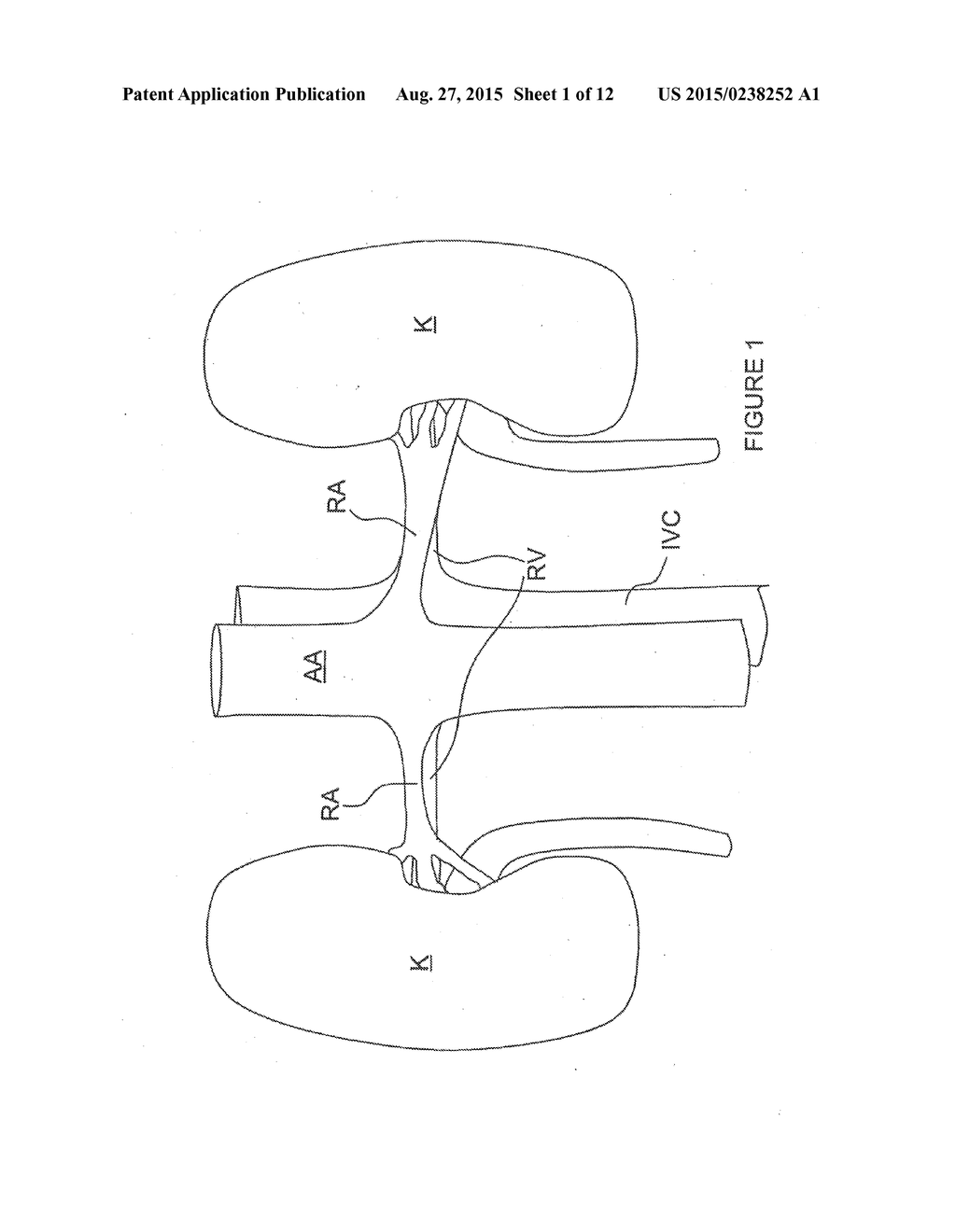 Methods and Apparatus for Renal Neuromodulation - diagram, schematic, and image 02