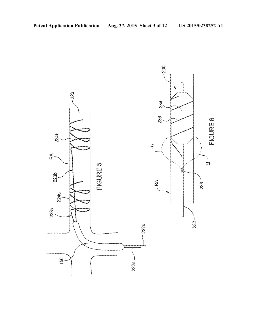 Methods and Apparatus for Renal Neuromodulation - diagram, schematic, and image 04