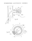 APPARATUS, SYSTEMS, AND METHODS FOR ACHIEVING INTRAVASCULAR,     THERMALLY-INDUCED RENAL NEUROMODULATION diagram and image