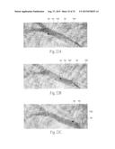 APPARATUS, SYSTEMS, AND METHODS FOR ACHIEVING INTRAVASCULAR,     THERMALLY-INDUCED RENAL NEUROMODULATION diagram and image