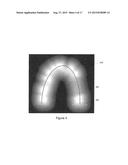 SURGICAL TEMPLATE diagram and image