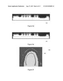 SURGICAL TEMPLATE diagram and image