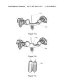 SURGICAL TEMPLATE diagram and image