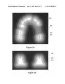 VIRTUAL SPLINT diagram and image