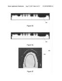 VIRTUAL SPLINT diagram and image