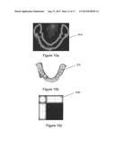 VIRTUAL SPLINT diagram and image