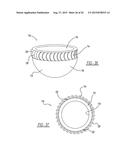Implant Fixation Device diagram and image