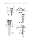 POLYAXIAL ADJUSTMENT OF FACET JOINT PROSTHESES diagram and image