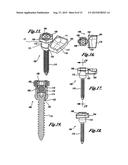 POLYAXIAL ADJUSTMENT OF FACET JOINT PROSTHESES diagram and image