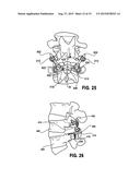 POLYAXIAL ADJUSTMENT OF FACET JOINT PROSTHESES diagram and image