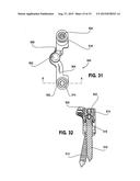 POLYAXIAL ADJUSTMENT OF FACET JOINT PROSTHESES diagram and image