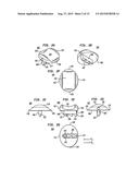 INTERVERTEBRAL DISC IMPLANTS AND TOOLING diagram and image