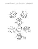 INTERVERTEBRAL DISC IMPLANTS AND TOOLING diagram and image