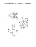 INTERVERTEBRAL DISC IMPLANTS AND TOOLING diagram and image