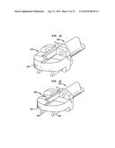 INTERVERTEBRAL DISC IMPLANTS AND TOOLING diagram and image