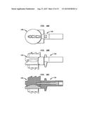 INTERVERTEBRAL DISC IMPLANTS AND TOOLING diagram and image