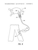 BLOOD FLOW MANAGEMENT METHODS AND SYSTEMS diagram and image