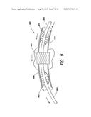 BLOOD FLOW MANAGEMENT METHODS AND SYSTEMS diagram and image