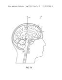 Method and System for Enhanced Imaging Visualization of Deep Brain Anatomy     Using Infusion diagram and image