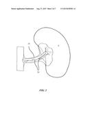 IMAGE-GUIDED TISSUE ABLATION diagram and image