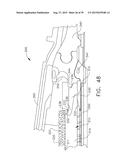 IMPLANTABLE LAYERS AND METHODS FOR ALTERING ONE OR MORE PROPERTIES OF     IMPLANTABLE LAYERS FOR USE WITH FASTENING INSTRUMENTS diagram and image