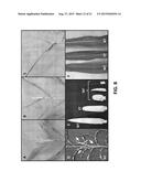 Genetic reduction of male fertility in plants diagram and image