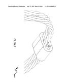 Sound Abatement System and Method diagram and image