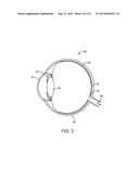 PHYSICAL ACTUATORS COUPLED TO OPTICAL FIBER CORES FOR AUGMENTED OR VIRTUAL     REALITY diagram and image