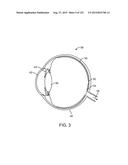 ATTENUATING OUTSIDE LIGHT FOR AUGMENTED OR VIRTUAL REALITY diagram and image