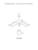 ATTENUATING OUTSIDE LIGHT FOR AUGMENTED OR VIRTUAL REALITY diagram and image