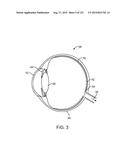 LENS ARRAY OPERATIVELY COUPLED TO A SPATIAL LIGHT MODULATOR FOR AUGMENTED     OR VIRTUAL REALITY diagram and image