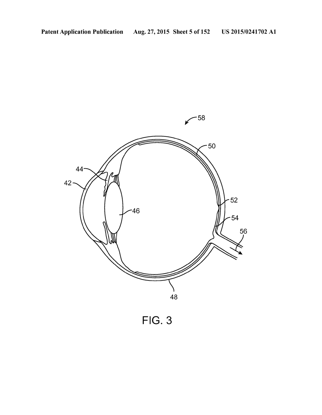 LENS ARRAY OPERATIVELY COUPLED TO A SPATIAL LIGHT MODULATOR FOR AUGMENTED     OR VIRTUAL REALITY - diagram, schematic, and image 06