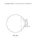 LENS ARRAY OPERATIVELY COUPLED TO A SPATIAL LIGHT MODULATOR FOR AUGMENTED     OR VIRTUAL REALITY diagram and image