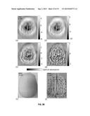 TRANSCRANIAL PHOTOACOUSTIC/THERMOACOUSTIC TOMOGRAPHY BRAIN IMAGING     INFORMED BY ADJUNCT IMAGE DATA diagram and image