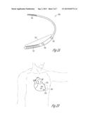 DIFFERENTIATING DECOMPENSATION DETECTION BASED ON CO-MORBIDITIES IN HEART     FAILURE diagram and image