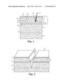 INCISION PROTECTION diagram and image