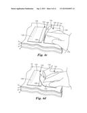 INCISION PROTECTION diagram and image