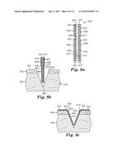 INCISION PROTECTION diagram and image