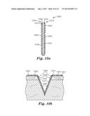 INCISION PROTECTION diagram and image