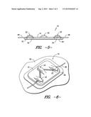 Catheter Strain Relief Clip diagram and image