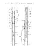 EXPANSION ASSEMBLY, TOP ANCHOR AND METHOD FOR EXPANDING A TUBULAR IN A     WELLBORE diagram and image
