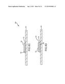 INTERPOSER PACKAGE-ON-PACKAGE STRUCTURE diagram and image