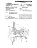 REMOVABLE ATTACHMENT OF A PASSIVE TRANSCUTANEOUS BONE CONDUCTION DEVICE     WITH LIMITED SKIN DEFORMATION diagram and image