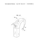 REMOVABLE ATTACHMENT OF A PASSIVE TRANSCUTANEOUS BONE CONDUCTION DEVICE     WITH LIMITED SKIN DEFORMATION diagram and image