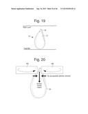 METHODS OF EXTRACTING MONOCOT EMBRYOS diagram and image