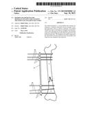 Method and Apparatus for Minimally Invasive Subcutaneous Treatment of Long     Bone Fractures diagram and image